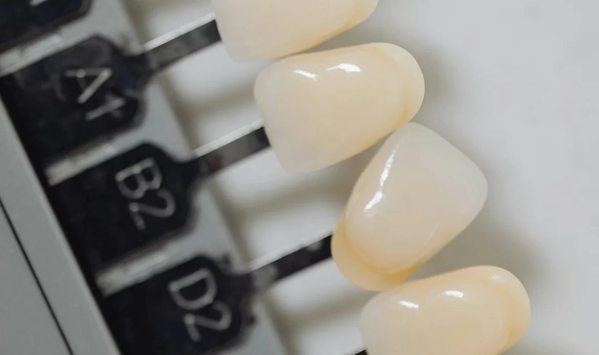 Porcelain veneers, made from non-porous glass-ceramic.