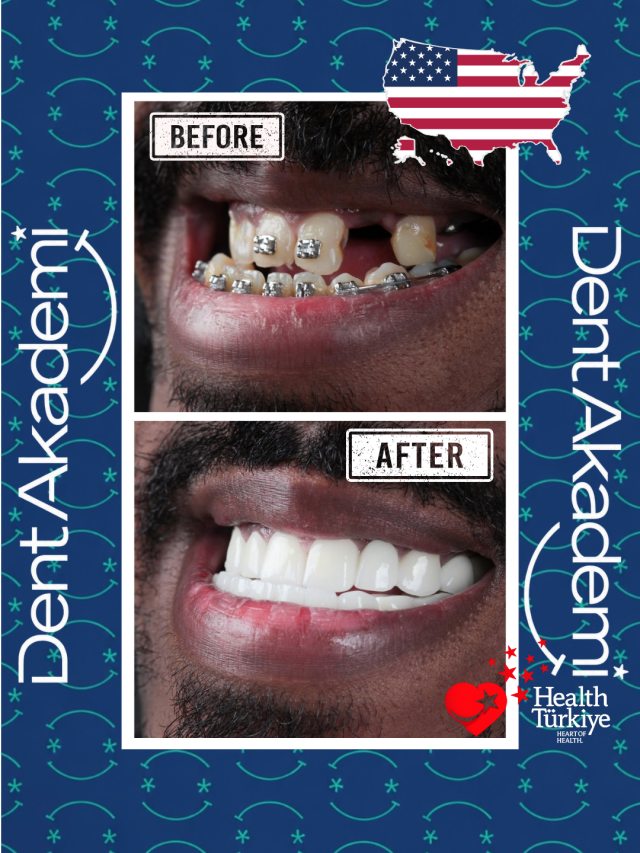 Smile-design2-Istanbul