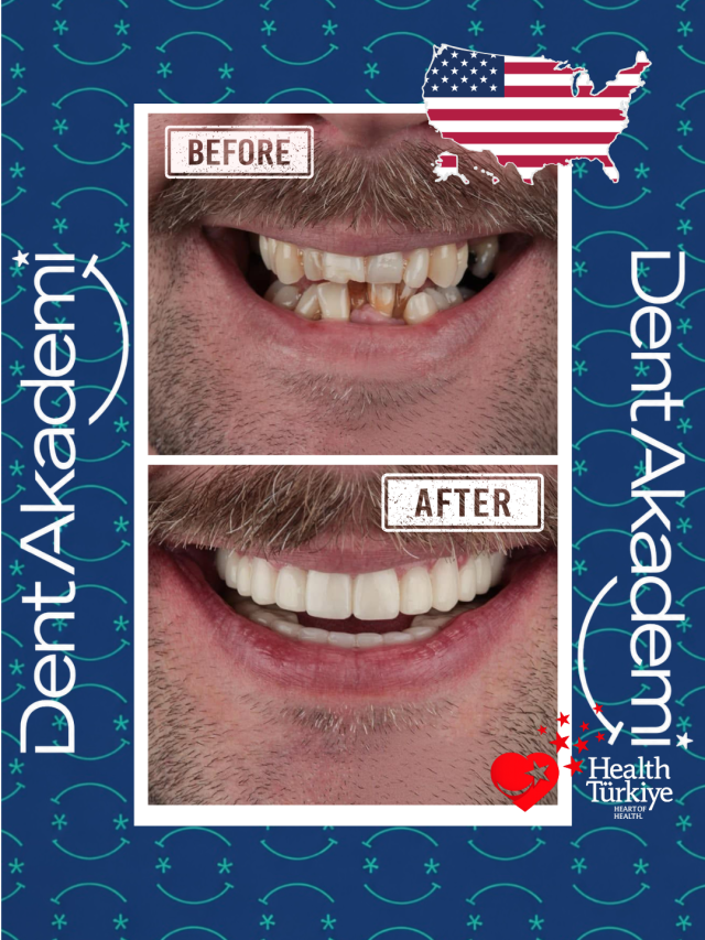 Real Smiles, Real Transformations – Full Mouth Restoration
